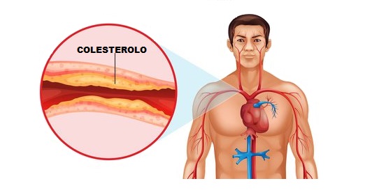 Colesterolo-Buono-E-Cattivo